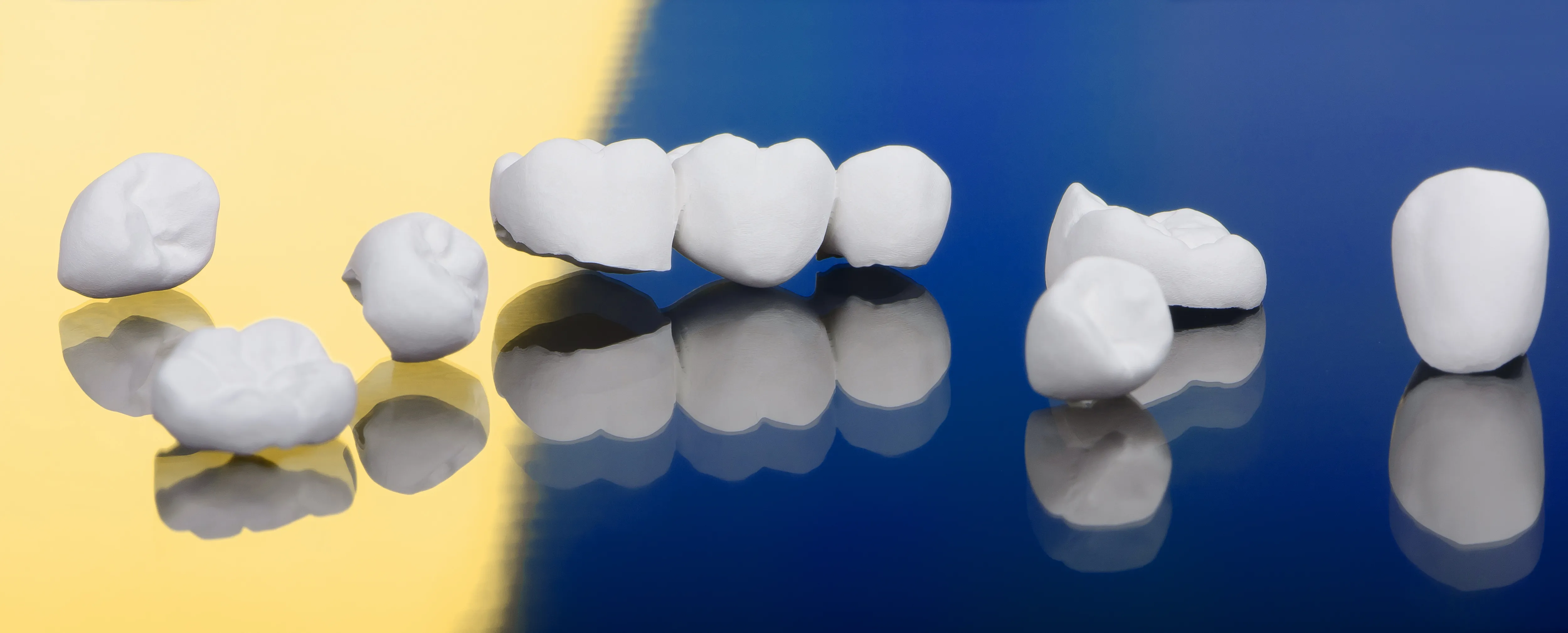 Dental Crown and Bridge Treatment in Ahmedabad