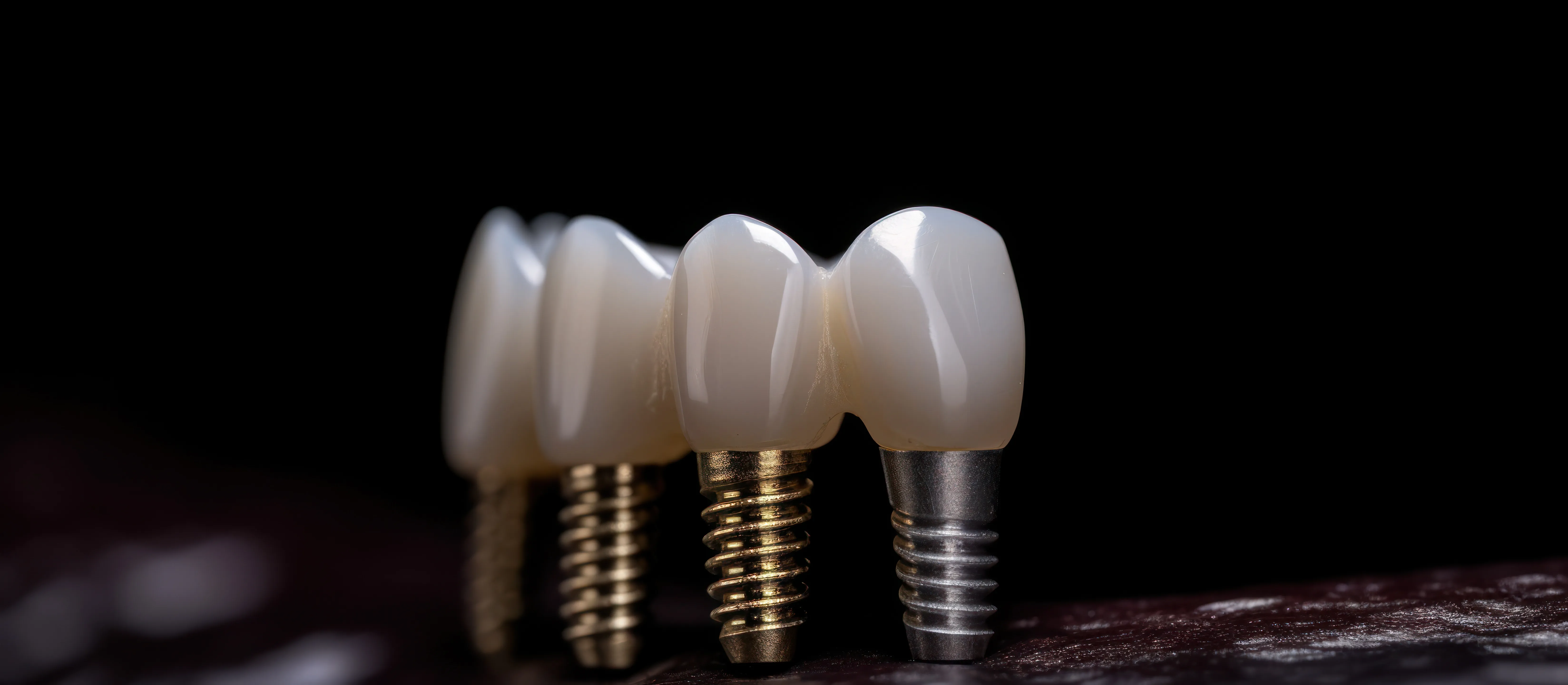 Dental Implants in Ahmedabad
