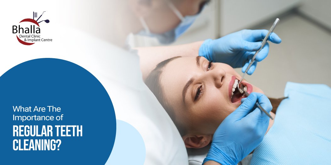 What Are the Importance of Regular Teeth Cleaning? | Oral Health Guide