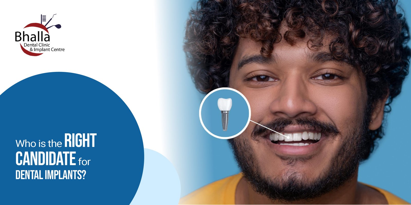 Who Is the Right Candidate for Dental Implants?